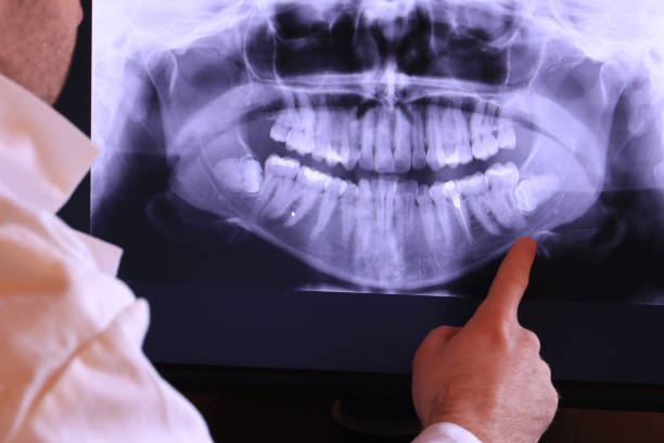 Best Same-Day Emergency Dental Services in Pocahontas, AR